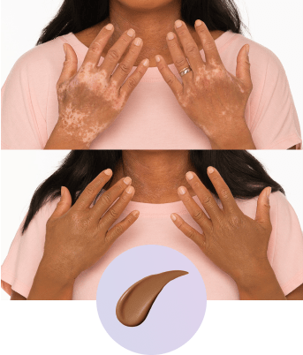 Olirea™ | Crema de cobertura corporal
