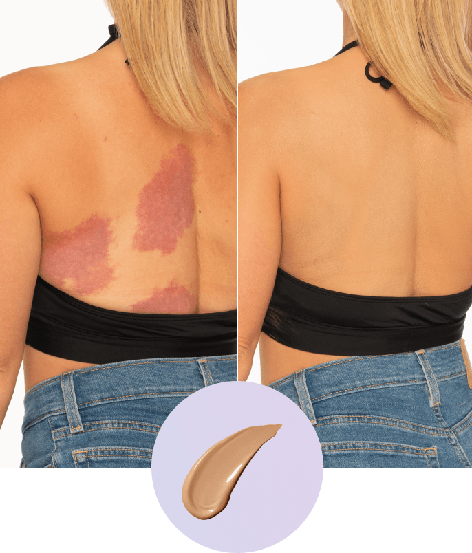 Olirea™ | Crema de cobertura corporal
