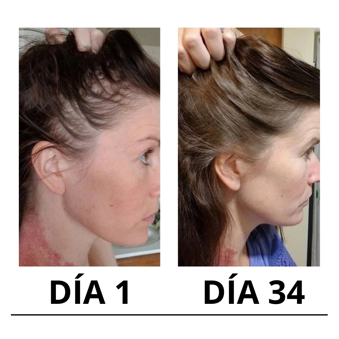 Cirvano™ | Serum de crecimiento de pelo y anticaída