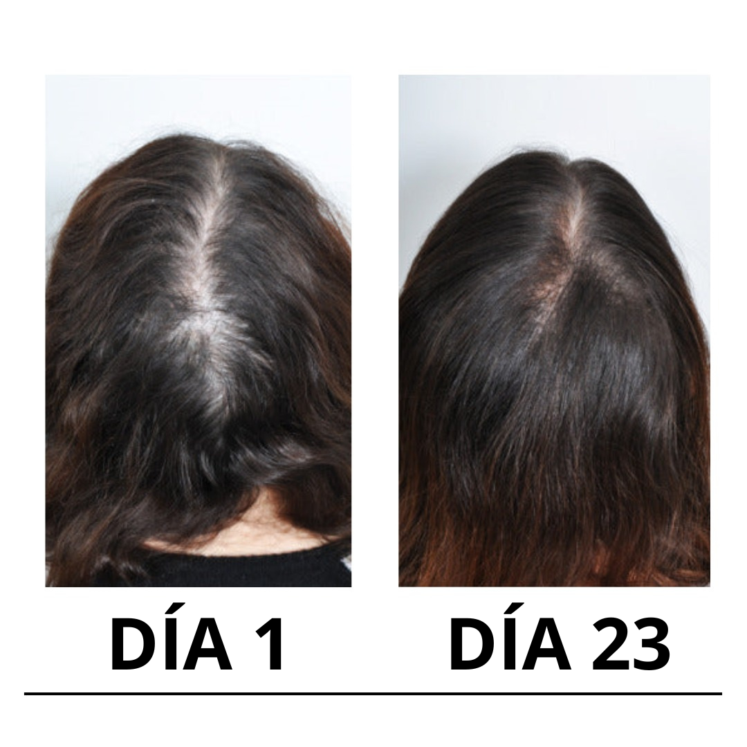 Cirvano™ | Serum de crecimiento de pelo y anticaída