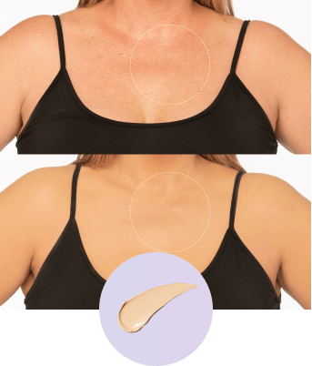 Olirea™ | Crema de cobertura corporal