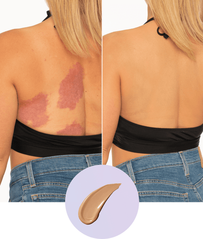 Olirea™ | Crema de cobertura corporal