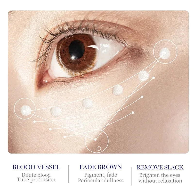 Crema antiojeras