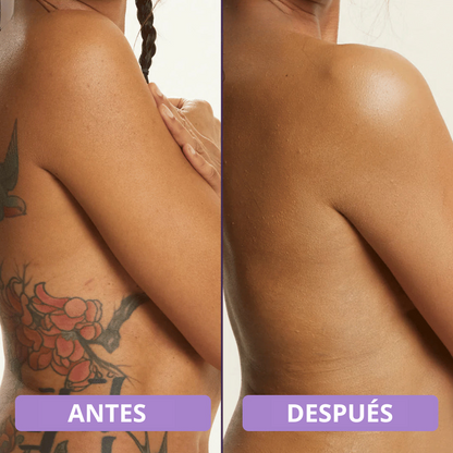 Olirea™ | Crema de cobertura corporal
