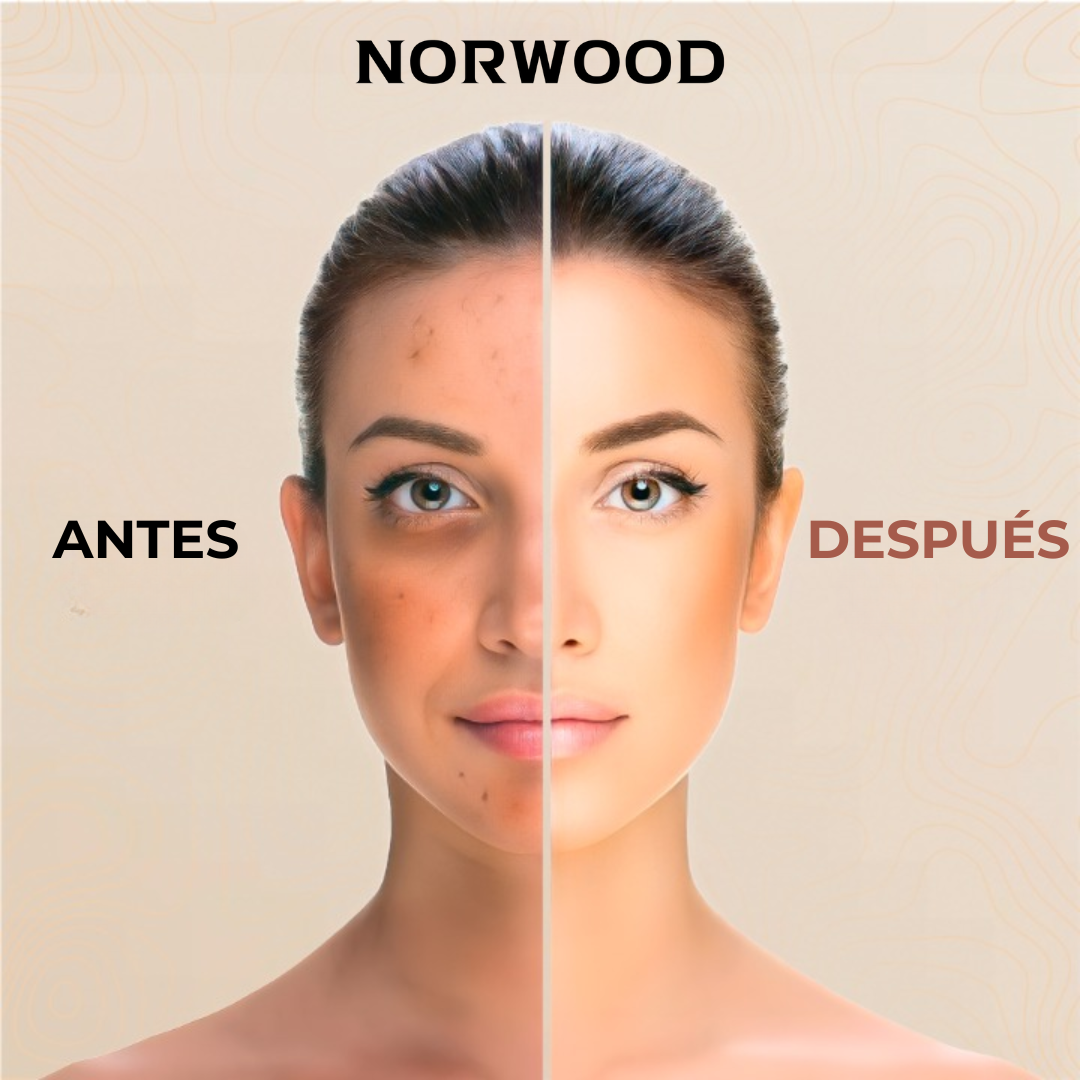 Norwood | Tinte de piel natural