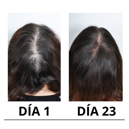 Cirvano™ | Serum de crecimiento de pelo y anticaída