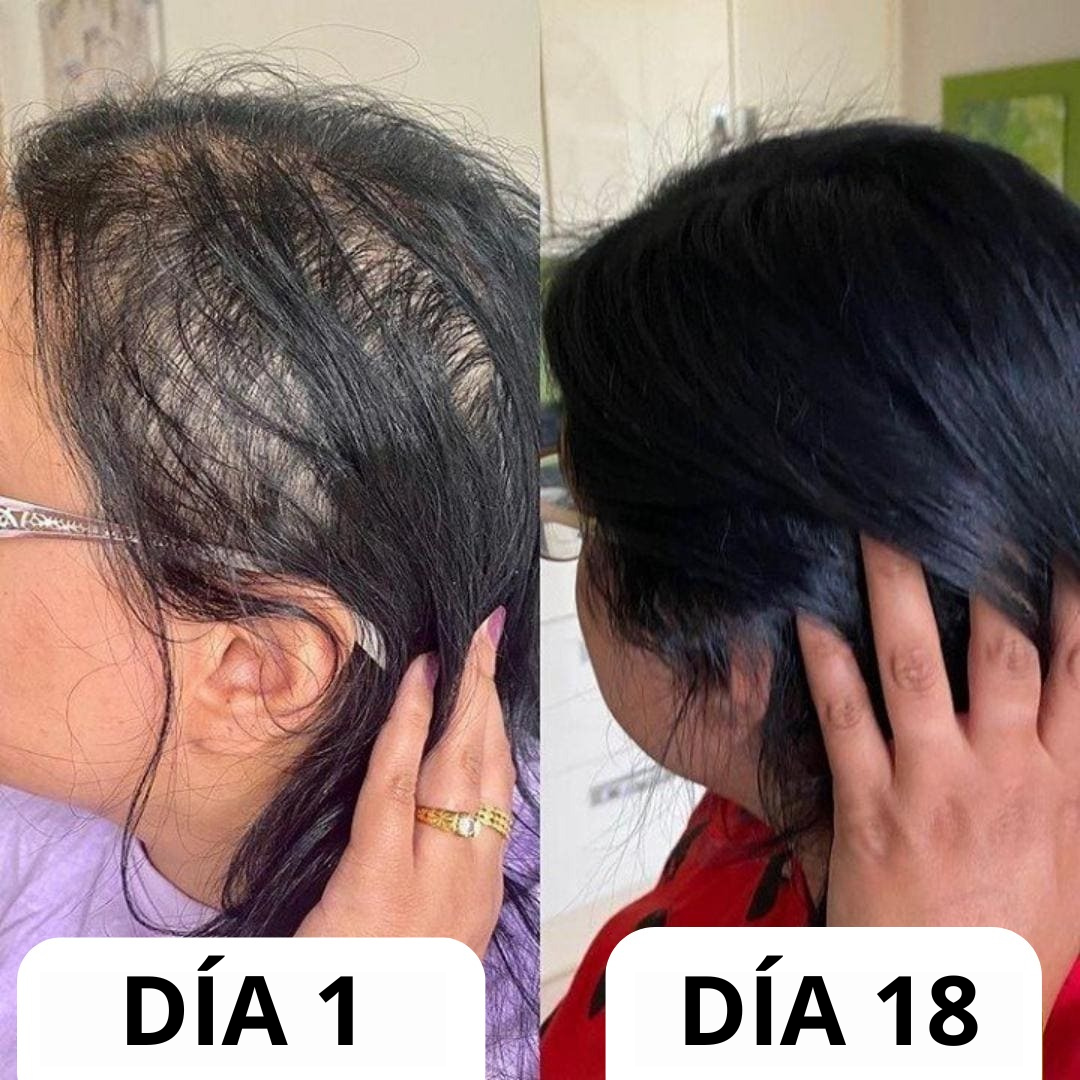 Cirvano™ | Serum de crecimiento de pelo y anticaída